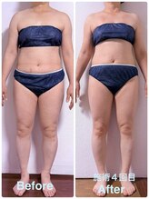 サロン アモル(salon amor)/インディバで全身スッキリ