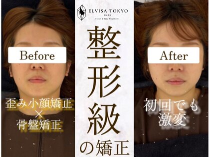 エレヴィザ トウキョウ 恵比寿院(ELVISA TOKYO)の写真