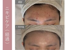 ジョルネ 中目黒(jornee.)/before/after １年半後