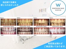 ホワイトニングショップ 春日井店(whitening shop)