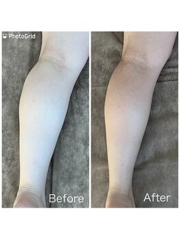 ポノーラ(Ponola)/インドエステ