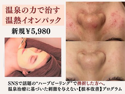 アクール(Accueil)の写真