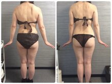 美容整体ウェリナ あま甚目寺院/小顔矯正/骨盤矯正/美脚サロン