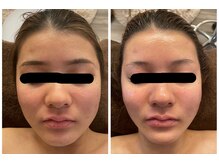 モゼ(moze)/ヒト幹細胞ってすごい！！