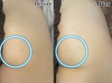 ビ ボーテ(美 Beaute)/その場で変化が出る！