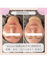 ミュー 豊田店(mieux)/◆肌本来のポテンシャルを引出す