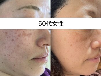 サクラ 本厚木駅前店(SAKURA)/本厚木シミケア/伊勢店シミケア