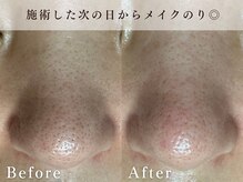 ハリウッド ラボ 本店(HOLLYWOOD LAB)/