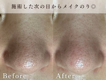 ハリウッド ラボ 本店(HOLLYWOOD LAB)/