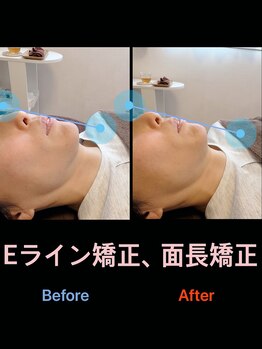 美容矯正サロン レレポノ(LELEPONO)/