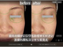 ダイヤモンドトゥルース(Diamond truth)/老け見えは目元から改善