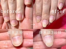 スマイル ネイル ラボラトリー(Smile nail laboratory)