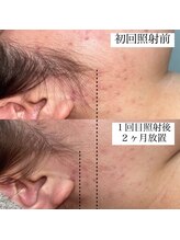 テンパ ビューティー(+10%beauty)/効果写真