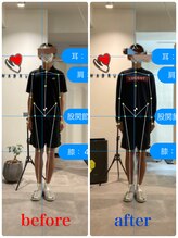 ナオル整体 新宿院(NAORU整体)/30代男性-姿勢矯正 3ヶ月経過