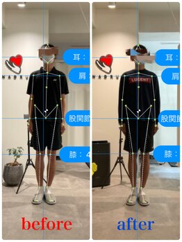 ナオル整体 新宿院(NAORU整体)/30代男性-姿勢矯正 3ヶ月経過