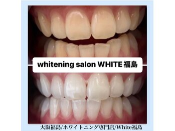 ホワイトニングサロン ホワイト(WHITE)/セルフホワイトニング/大阪/福島