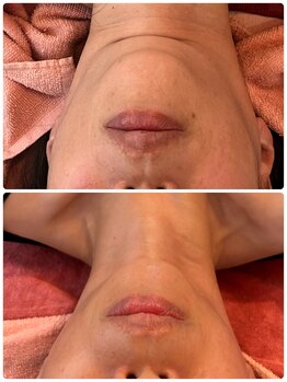 ダーナ(Danam)/気になる二重あごもスッキリ!!