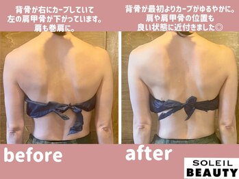 ソレイユビューティー 愛知大学前(SOLEIL BEAUTY)/背骨の歪みもしっかり補正！！
