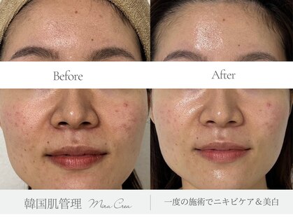 ミラクレア(Mira Crea)の写真