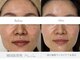 ミラクレア(Mira Crea)の写真