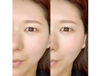 グロウビューティー(grow beauty)/