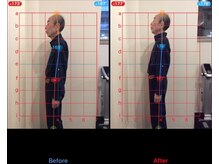 ケアハウス センター南(CARE HOUSE)/施術効果写真☆（before after）