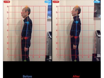 ケアハウス センター南(CARE HOUSE)/施術効果写真☆(before after)