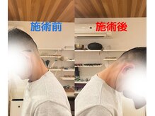 さくらの整体院の雰囲気（首肩のこりと重だるさが取れて首の可動域もUP）