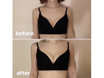 マホラ 本店(Mahora)/Before/After