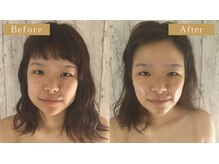 モモスパ(MOMOspa.)/頭蓋骨小顔矯正ビフォアフター