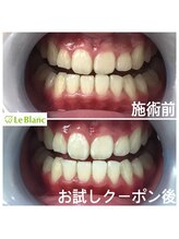 ルブラン 奈良店(Le Blanc)/ご家族で通って頂いております！