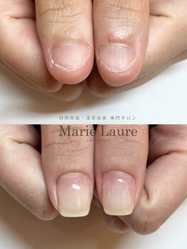 マリーロール 淀屋橋本店(Marie Laure)/自爪育成/深爪矯正/ネイルケア