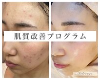 ベルージュ(Belrouge)