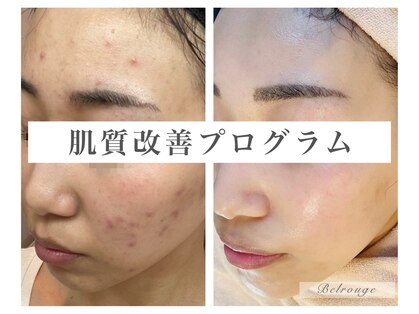 ベルージュ(Belrouge)の写真