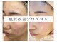 ベルージュ(Belrouge)の写真