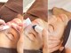 マハロハ 自由が丘(Mahaloha)の写真/【毛穴・シミ改善3施術☆】毛穴詰まり改善＆光で引き締め★シミ改善当て放題付！憧れの毛穴レス美肌に◇