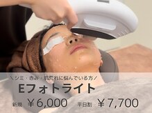 リモア(REMORE)/リモア以上に丁寧なサロンある？