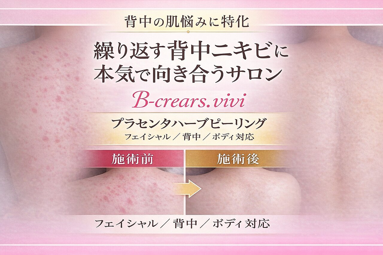 ビークレアーズ ビビ(B-crears. ViVi)｜ホットペッパービューティー