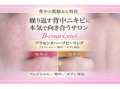 ビークレアーズ ビビ(B-crears. ViVi)の写真
