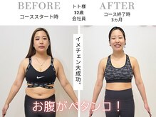 スリービーダイエット 町田店/ダイエットビフォーアフター