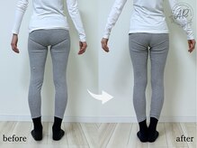 エーアール(AR)/【Before/After】5回目