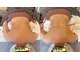 ジョジョイー(JoJoYEE)の写真/背中・姿勢を整え、女性らしい美しいラインへ