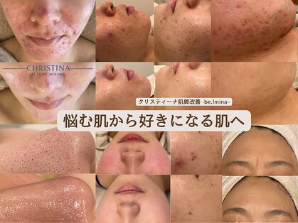 ベルミナ(BE.LMINA)の写真