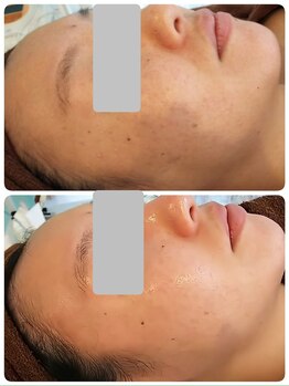 デイスパ コオリナ(DAYSPA Ko olina)/ファンデのり◎透明感◎