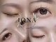 イオナ(IONA)の写真