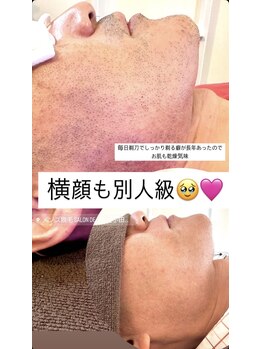 サロンドスパ(Salon de Spa)/ビフォーアフター