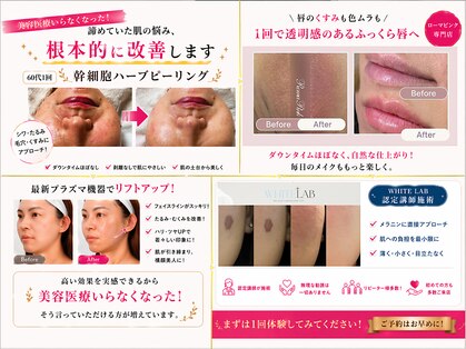 ラヌイ(LANUI)の写真