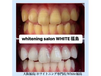 ホワイトニングサロン ホワイト(WHITE)/セルフホワイトニング/大阪/福島