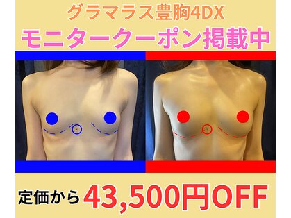 ポインセチア(Poinsettia)の写真