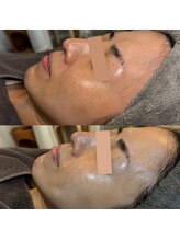 ビエン(美艶 b.en)/１回で印象ががらりと変わる♪